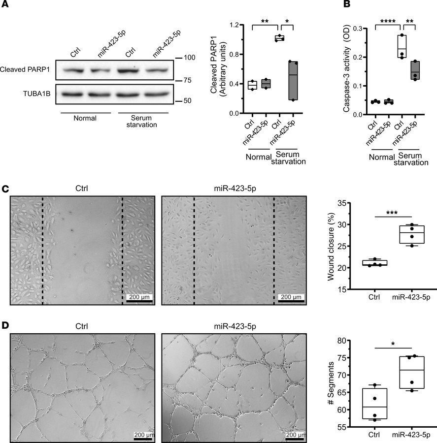 miR-423-5p protects endothelial cells from apoptosis and promotes endoth...