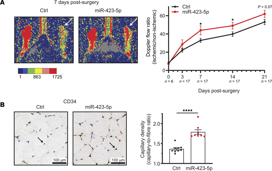 miR-423-5p increases neovascularization after hindlimb ischemia.
(A) Rep...