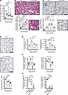 Assessment of renal injury, circulating extracellular vesicles, and circula