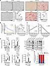 At a distance from IRI, lower miR-423-5p serum levels correlate with more s