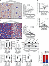 miR-423-5p serum levels predict microvascular rarefaction and fibrosis in h
