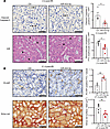 miR-423-5p attenuates microvascular injury and fibrogenesis after acute kid