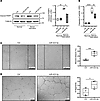 miR-423-5p protects endothelial cells from apoptosis and promotes endotheli