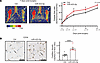 miR-423-5p increases neovascularization after hindlimb ischemia.