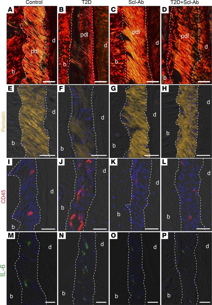 Scl-Ab therapy stimulates PDL repair.
(A–D) Picrosirius red staining, vi...