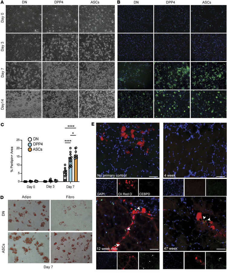 Lifr+/Procr+ stromal cell subpopulations demonstrate increased propensit...