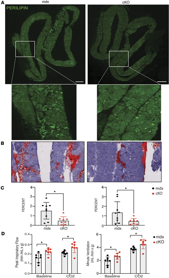 Intramuscular fat is reduced in cKO dystrophic muscles.
(A) Immunostaini...