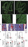 Intramuscular fat is reduced in cKO dystrophic muscles.