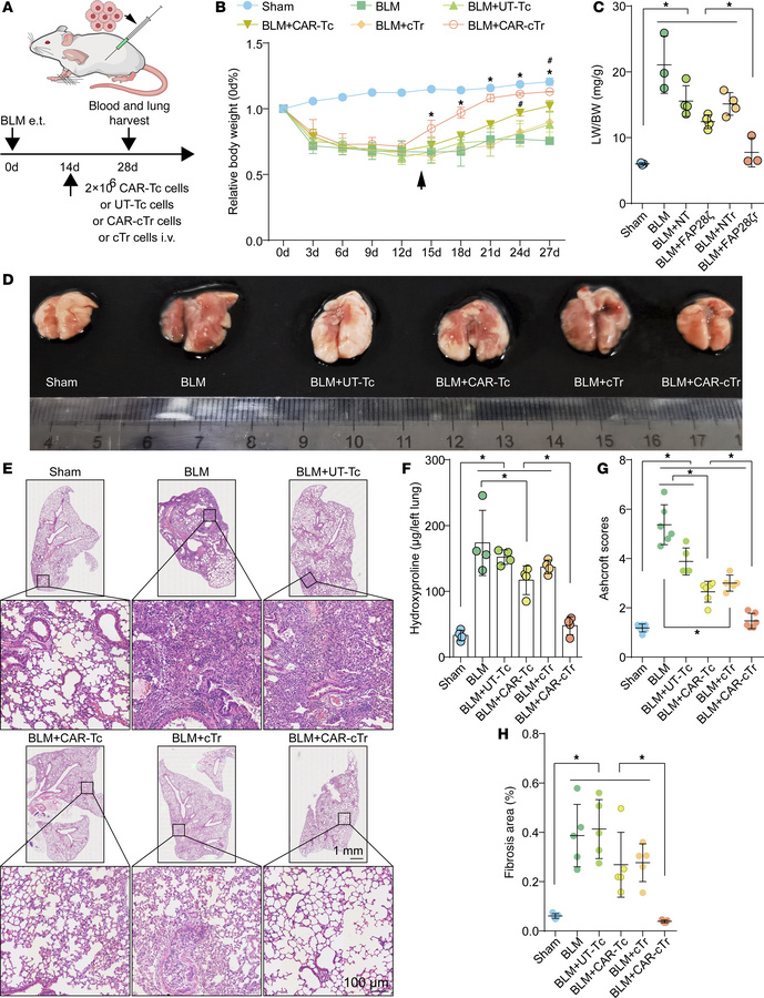 Antifibrotic effect of CAR-cTregs against BLM-induced lung fibrosis.
(A)...