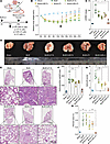 Antifibrotic effect of CAR-cTregs against BLM-induced lung fibrosis.