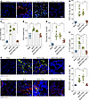 The recruitment of fibrocytes decreased and epithelial cell remodeling impr