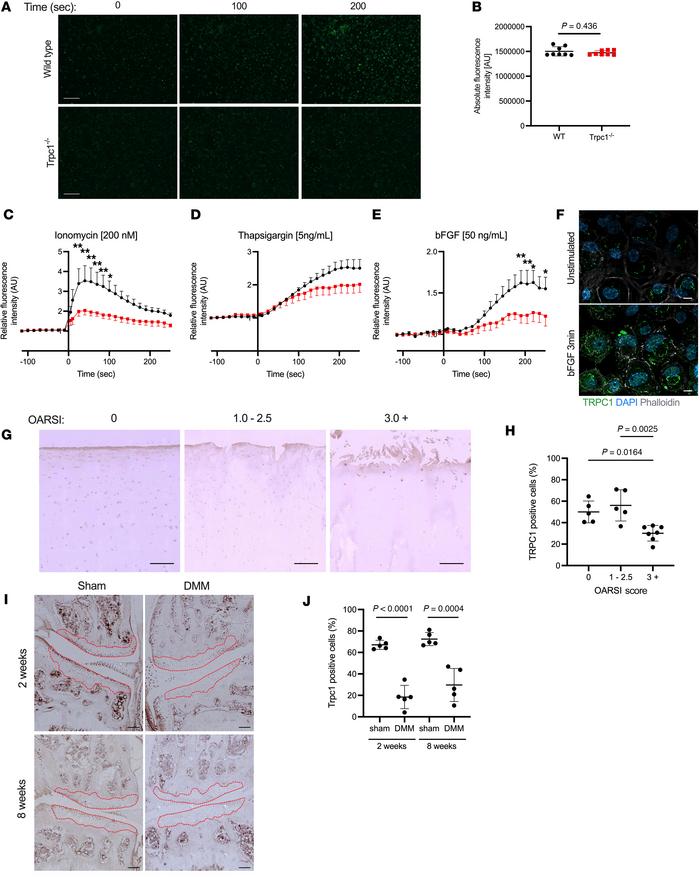 Analysis of TRPC1 protein expression in human and murine articular carti...