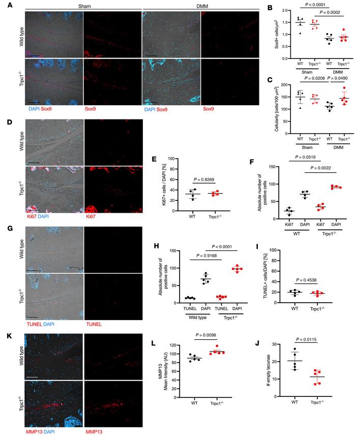 TRPC1-dependent phenotypic changes in cartilage during early stages of O...