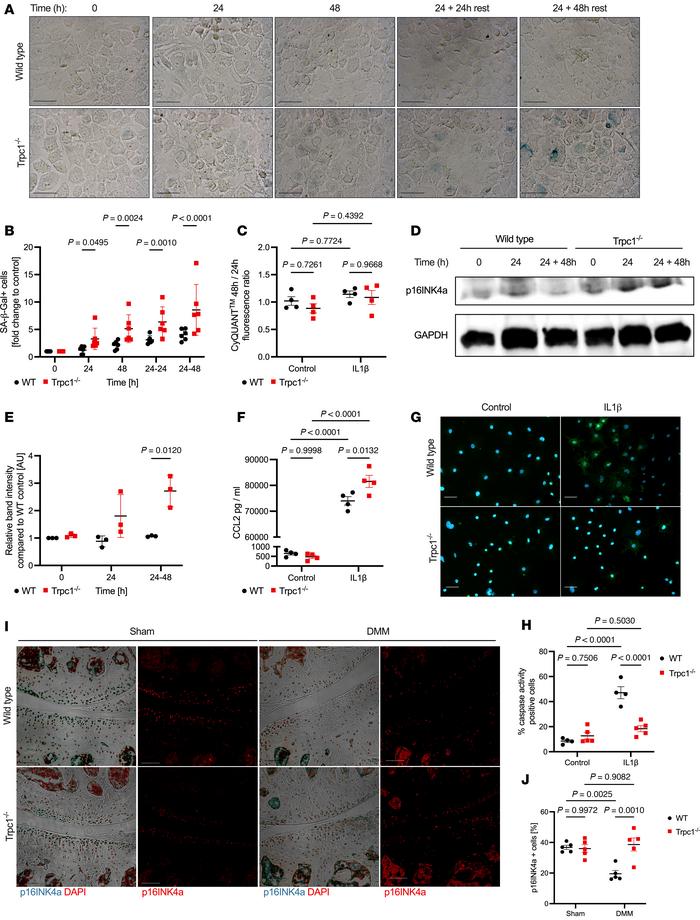 TRPC1 is required for protection against cellular senescence driven by I...