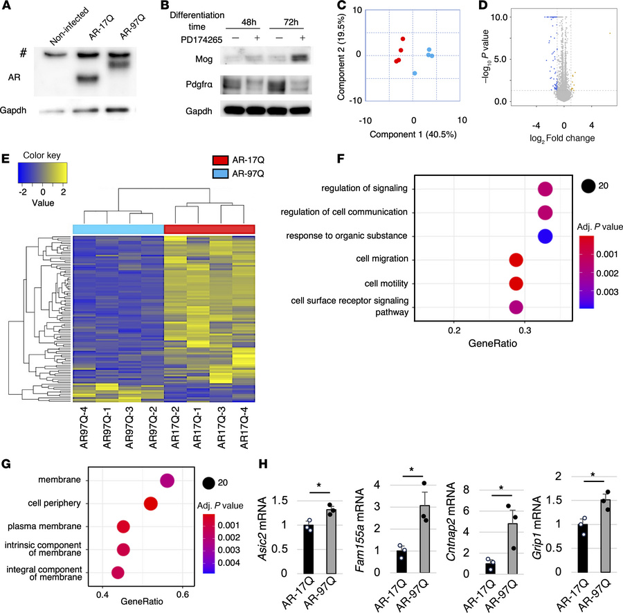 Oligodendrocyte cell model reflects the early pathogenesis of SBMA.
(A) ...