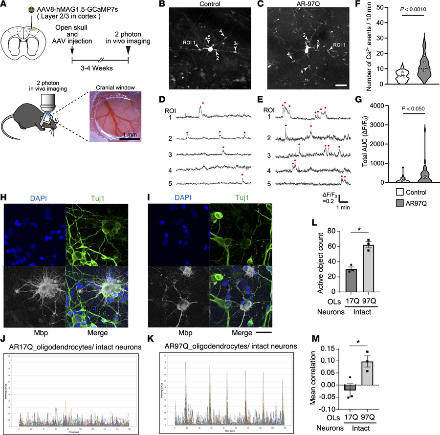 Oligodendrocytes in AR-97Q mice have increased Ca2+ activities, and muta...