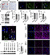 Oligodendrocytes are impaired in AR-97Q mice and patients with SBMA.