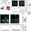 Oligodendrocytes in AR-97Q mice have increased Ca2+ activities, and mutant
