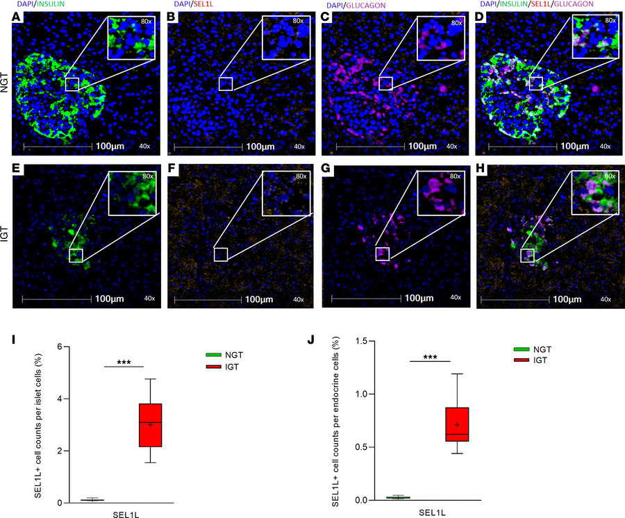 SEL1L expression in pancreatic samples from NGT and IGT individuals.
Rep...