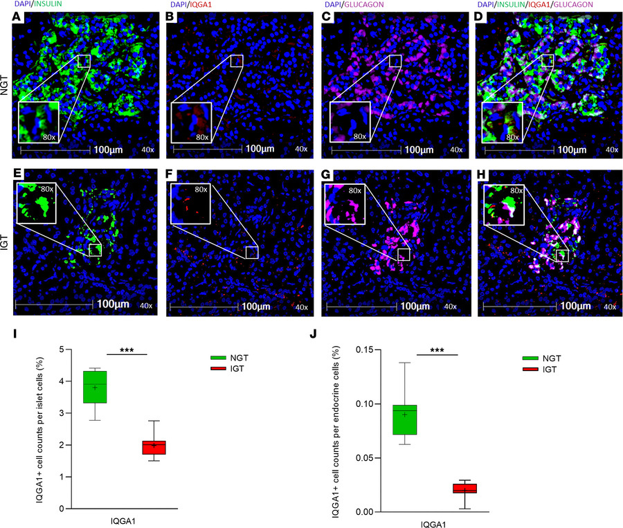 IQGA1 expression in pancreatic islets from patients with NGT and IGT.
Re...