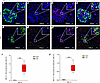 SEL1L expression in pancreatic samples from NGT and IGT individuals.