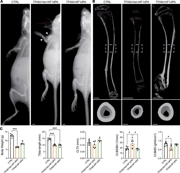 HIF1dPA corrects cortical defects observed in TFAM mutant mice but does ...