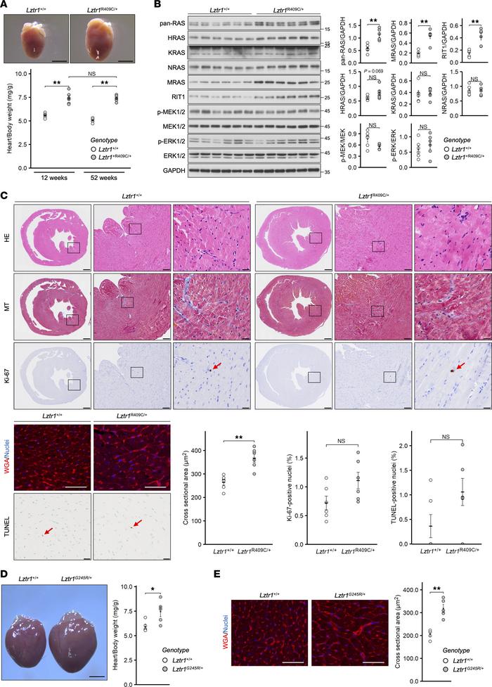 
Lztr1R409C/+ and Lztr1G245R/+ mice exhibit cardiac hypertrophy and high...