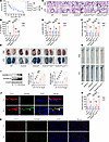 Endothelial Gsdmd deficiency protects against endothelial injury and death