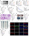 Deletion of hepatocyte Gsdmd decreases the endothelial GSDMD level and alle