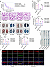 Hepatocyte GSDMD-mediated HMGB1 release regulates vascular injury and death