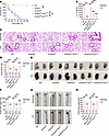 Endothelial Gsdmd deletion prevents vascular injury and death in sepsis.