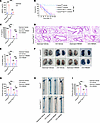 Hepatocyte Gsdmd deficiency inhibits HMGB1 release and vascular injury in s