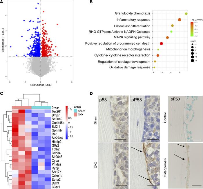 Gene profiling of Omacs in an osteoporosis mouse model assayed by bulk R...