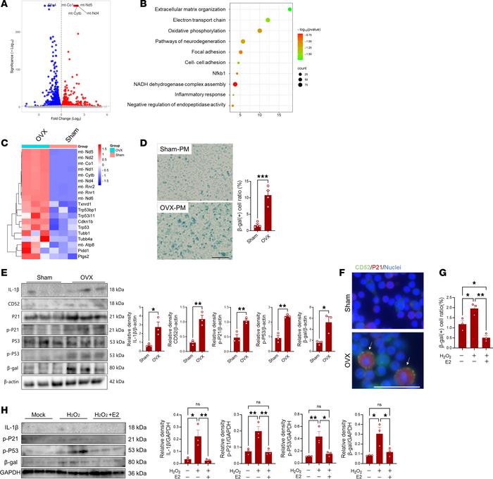 Role of estrogen in development of macrophage senescence.
(A) Volcano pl...