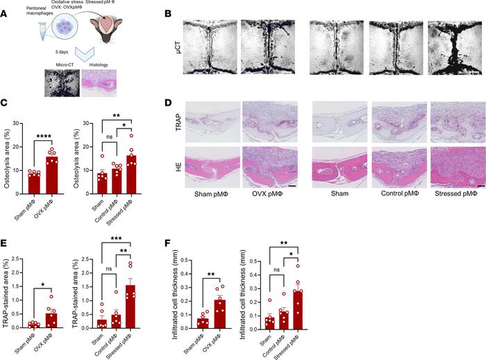 Pathological effects of adoptive transfer of macrophages onto calvarial ...