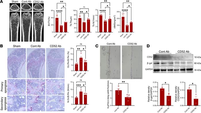 Therapeutic effects of depletion of CD52+ cells in OVX SCID mice.
(A) Re...