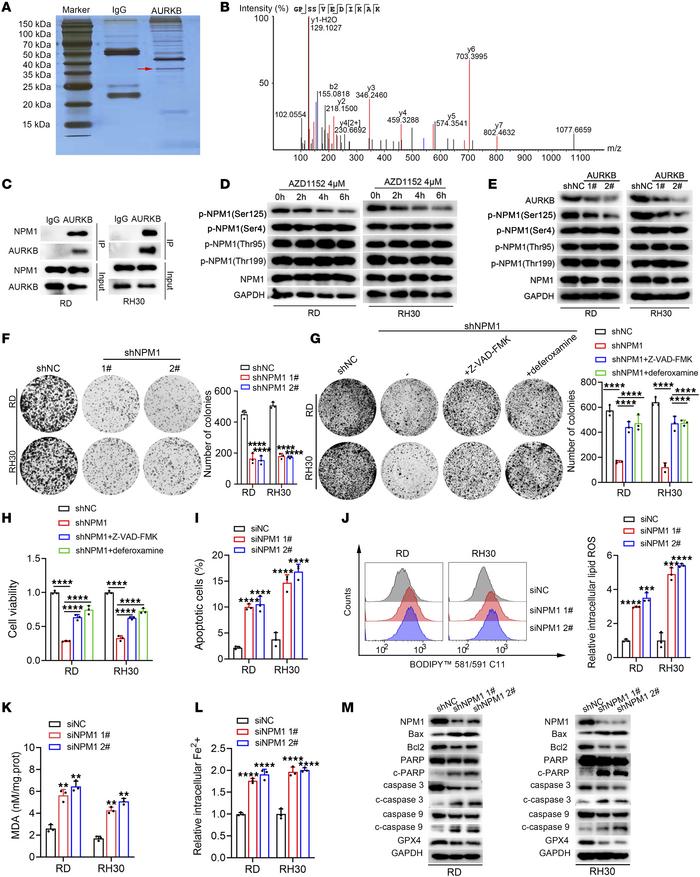 AURKB promoted apoptosis and ferroptosis resistance of RMS via phosphory...