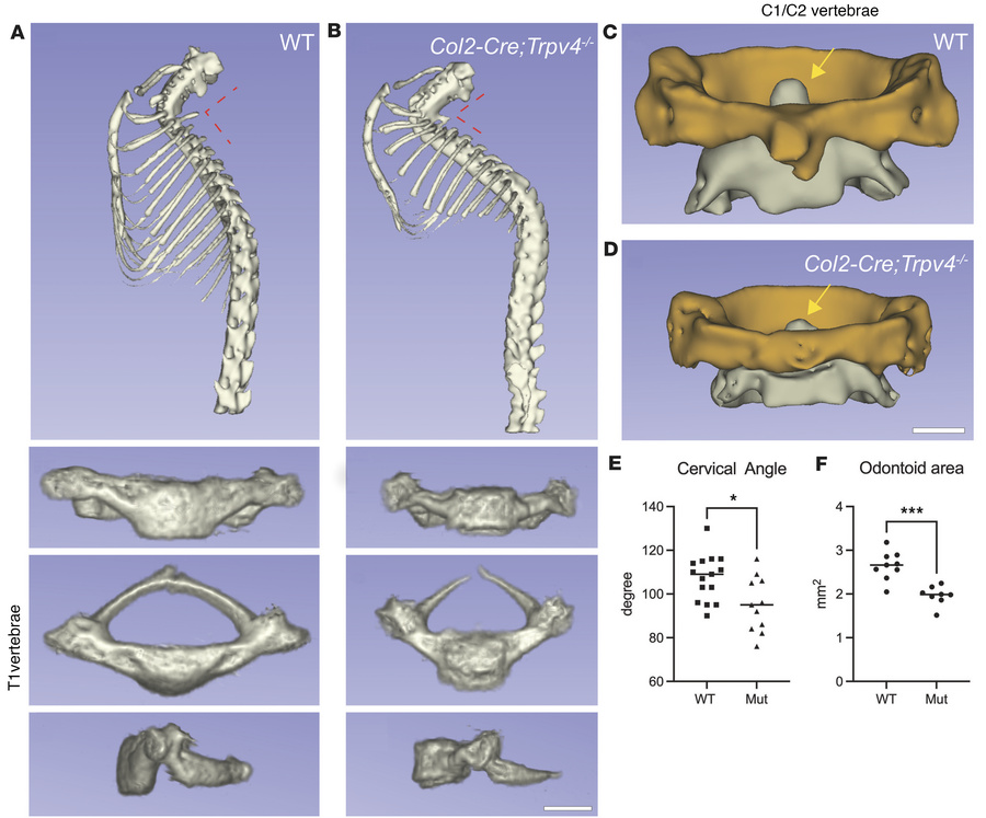 microCT of mouse atlantoaxial joint.
(A and B) Reconstructed μCT images ...