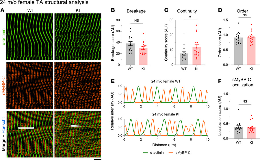 Quantitative evaluation of sarcomeric structure in 24-month-old female t...