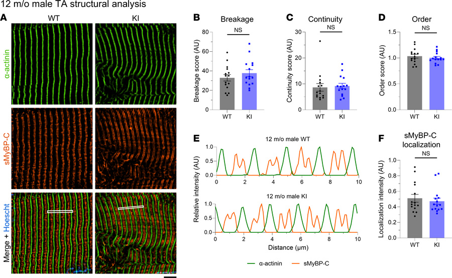 Quantitative evaluation of sarcomeric structure in 12-month-old male tib...