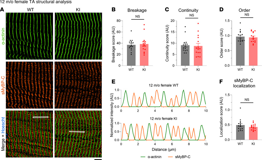 Quantitative evaluation of sarcomeric structure in 12-month-old female t...