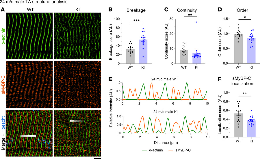 Quantitative evaluation of sarcomeric structure in 24-month-old male tib...