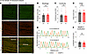 Quantitative evaluation of sarcomeric structure in 12-month-old female tibi