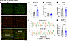 Quantitative evaluation of sarcomeric structure in 24-month-old male tibial
