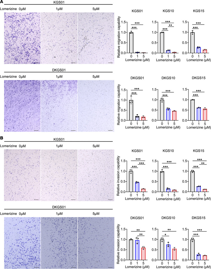 Effects of lomerizine on migration and invasion of glioblastoma cells.
T...