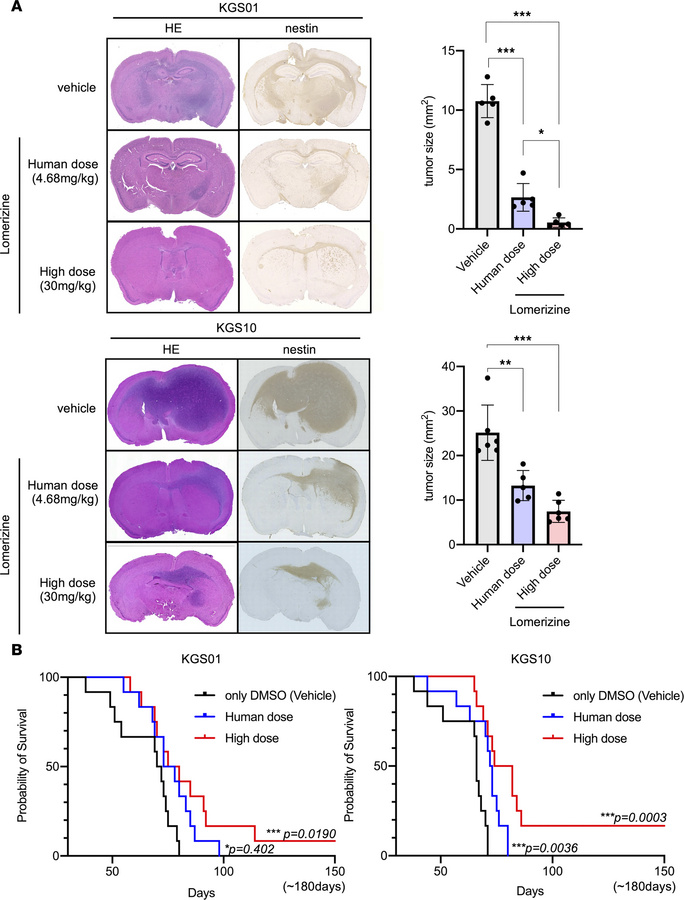 Effects of lomerizine treatment on the xenograft mouse model in vivo.
We...