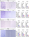 Effects of lomerizine on migration and invasion of glioblastoma cells.