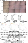 Effects of lomerizine on stemness in GICs.