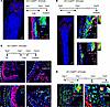The Postn+ cells may be derived from Gli1+ cells.