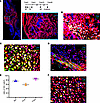 Postn+ cells could be reactivated in a successive bone fracture.